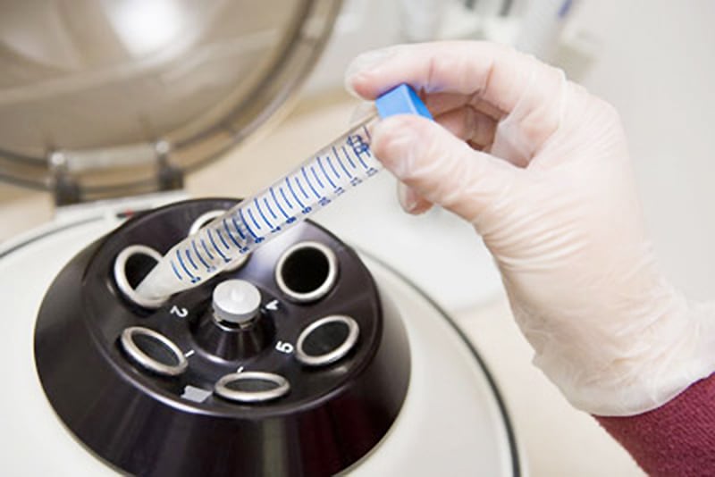 Sperm sample in the centrifuge tube