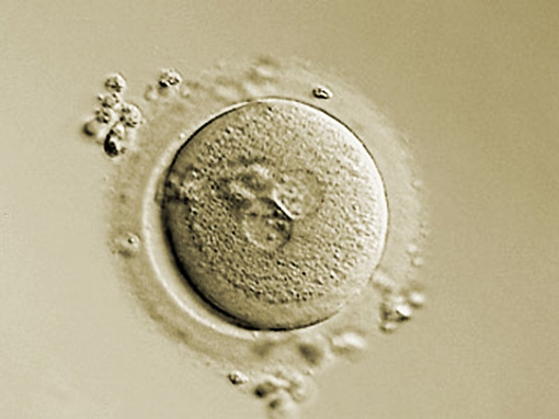 A so-called PN cell. A so-called PN cell. PN stands for pronucleus. The two pronuclei are clearly visible here.