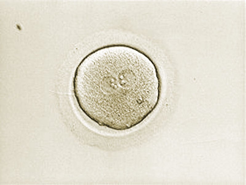 IVF