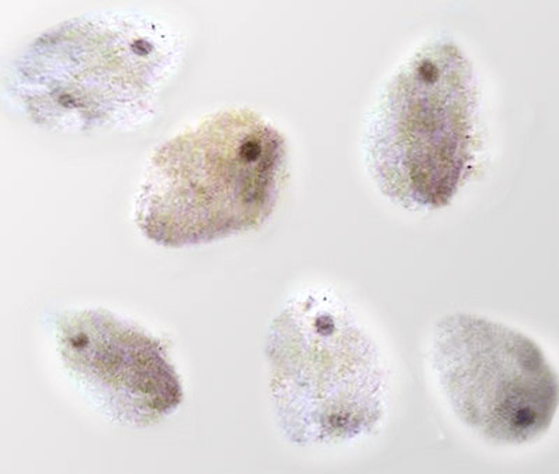 Granüloza hücreleri olarak bilinen ''kümülüs bulutlarındaki'' yumurta hücreleri
