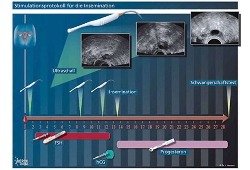 Insemination