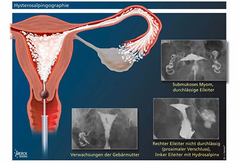 Diagram: Contrast examination